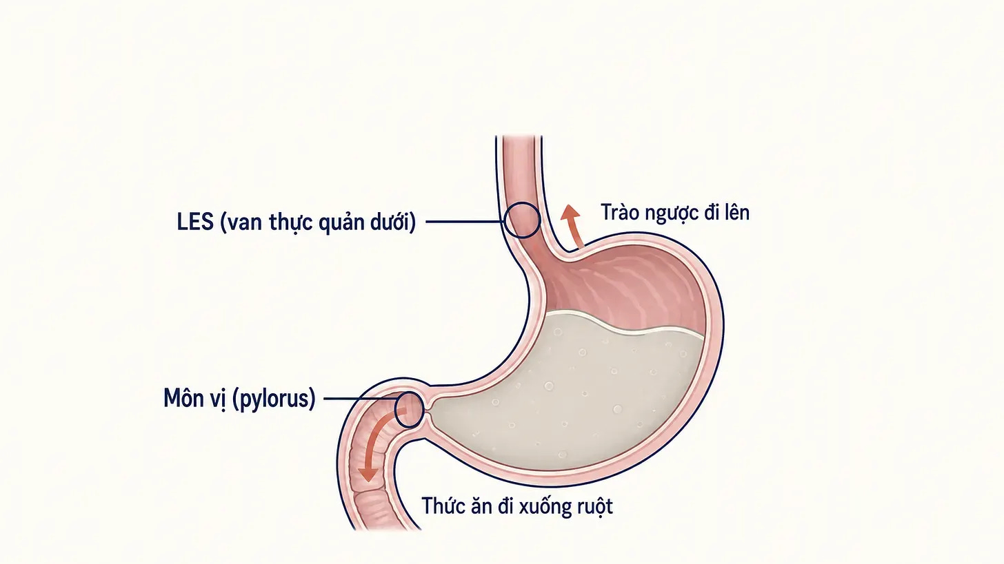 Sơ đồ cho thấy cơ vòng thực quản dưới LES nằm giữa thực quản và dạ dày, còn môn vị nằm ở đầu ra dạ dày; LES mới là hàng rào liên quan trực tiếp đến trào ngược.