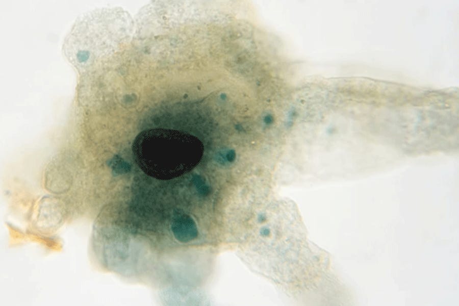 Naegleria fowleri, or the brain-eating amoeba, lives in lakes, rivers and hot springs. Naegleria fowleri, or the brain-eating amoeba, lives in lakes, rivers and hot springs.