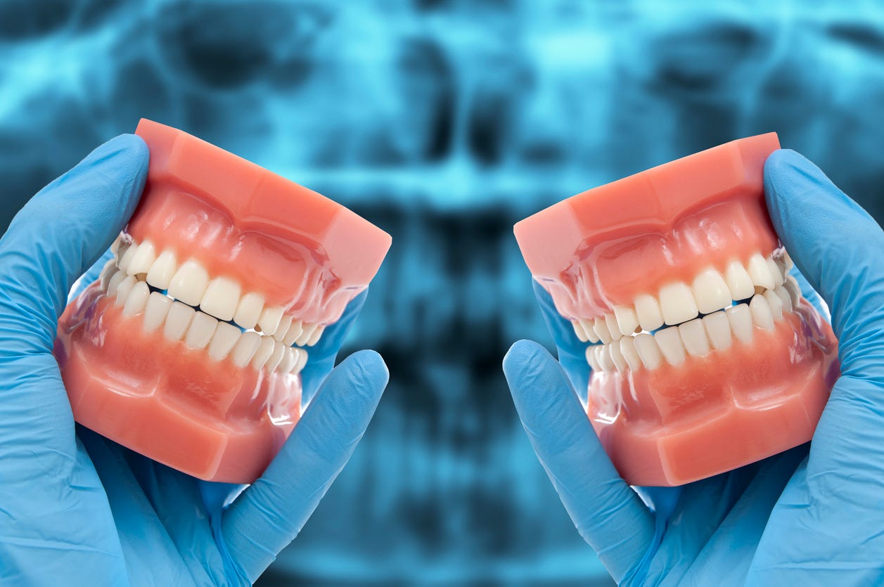Occlusion: Why Is Your Bite Important? - Ponte Vedra Complete Dentistry