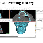 03-01-2016: Materialise launched the Materialise Mimics Care Suite, the platform for 3D printing in Hospitals