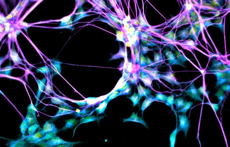 Filament style neural cells in blue and pink. Fluorescent light micrograph of groups of neural stem cells (neurospheres) in culture.