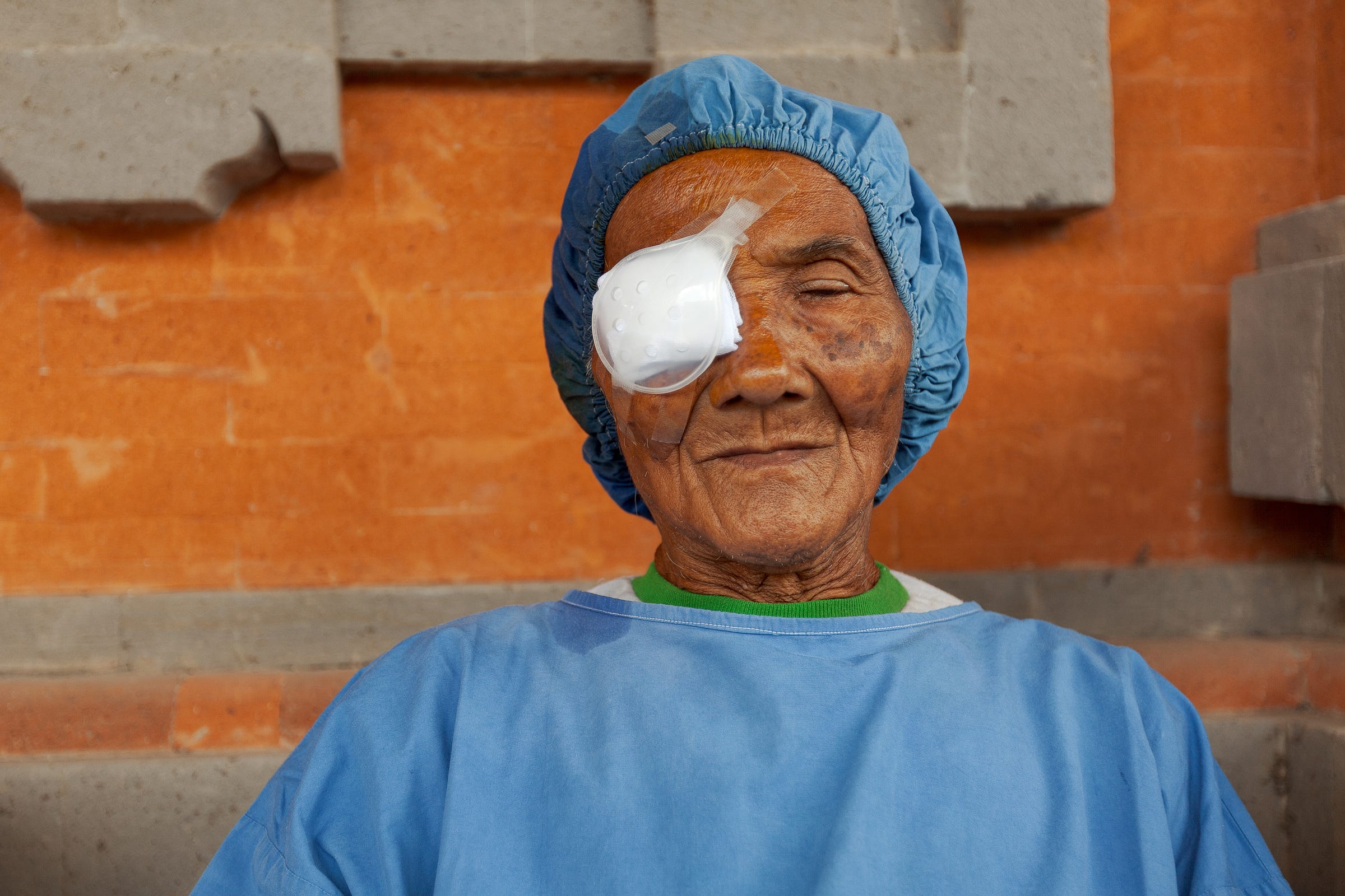 A patient after a cataract removal surgery. The surgery lasts only about 8-10 minutes. A patient after a cataract removal surgery. The surgery lasts only about 8-10 minutes.