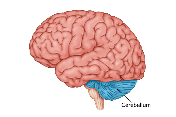 Cerebellum Brain Damage: Causes, Effects, and Rehabilitation Cerebellum Brain Damage: Causes, Effects, and Rehabilitation