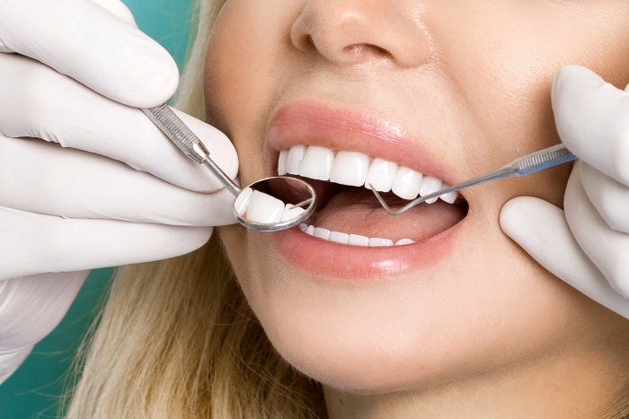 Porcelain Veneers in Antalya, Turkey: Cost and Advantages