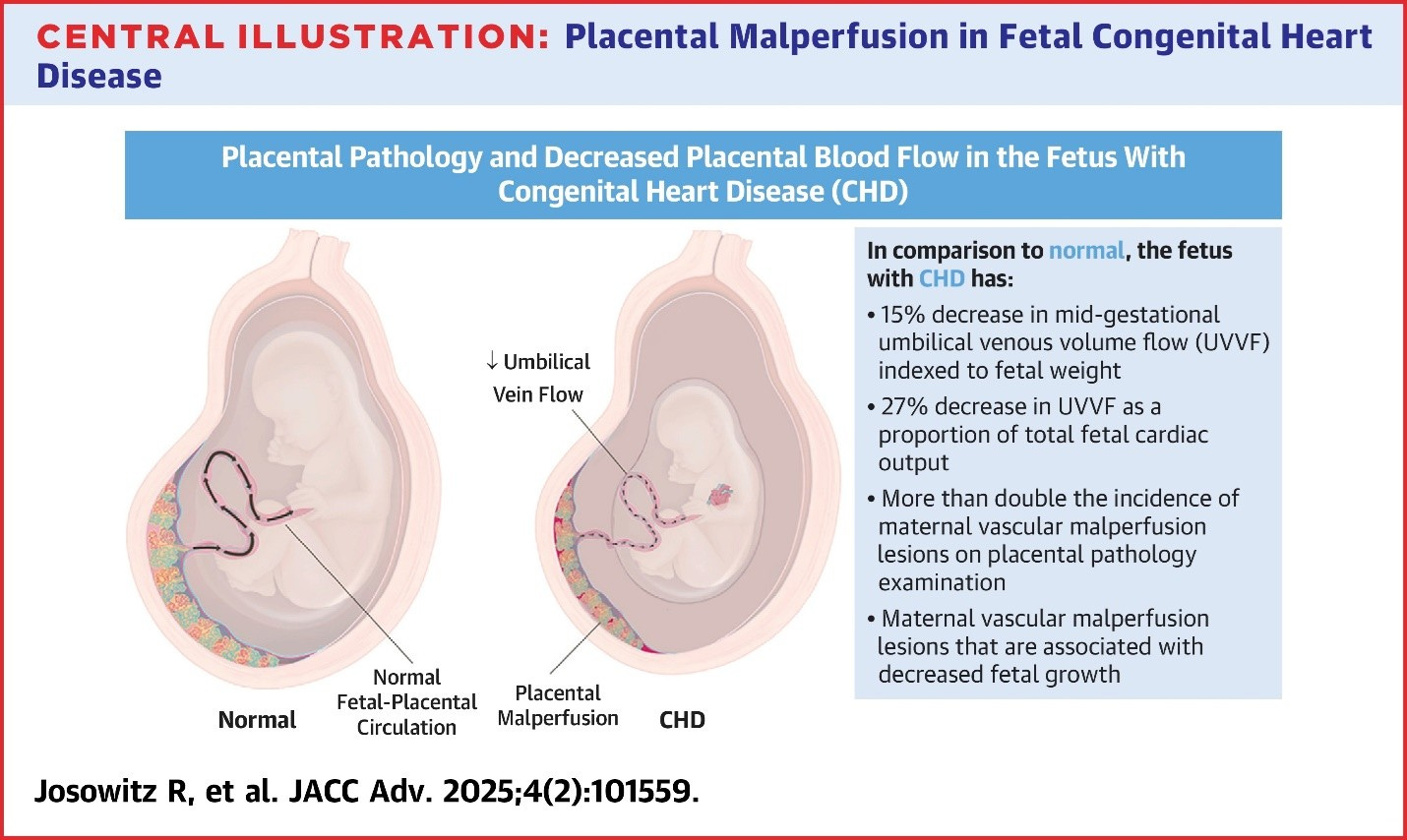 Placental Abnormities and the Development of Congenital Heart