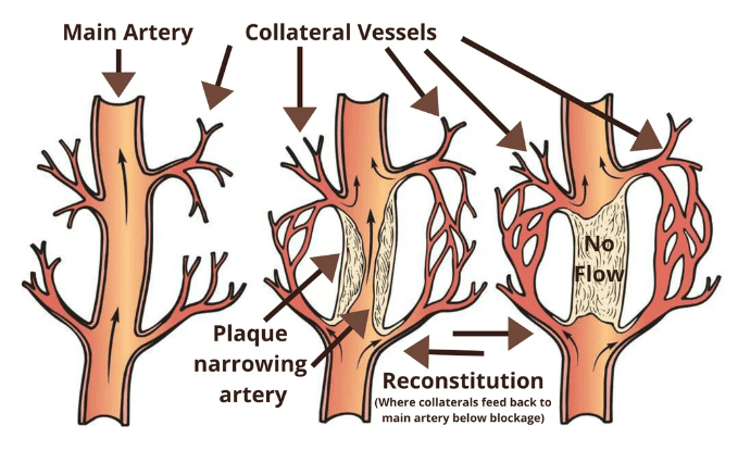 How To Walk Effectively To Improve Circulation - Heart...