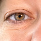 Decode: Iridology