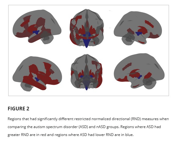 Images of regions in the brain that showed different neuron density between autistic people and non-autistic people.