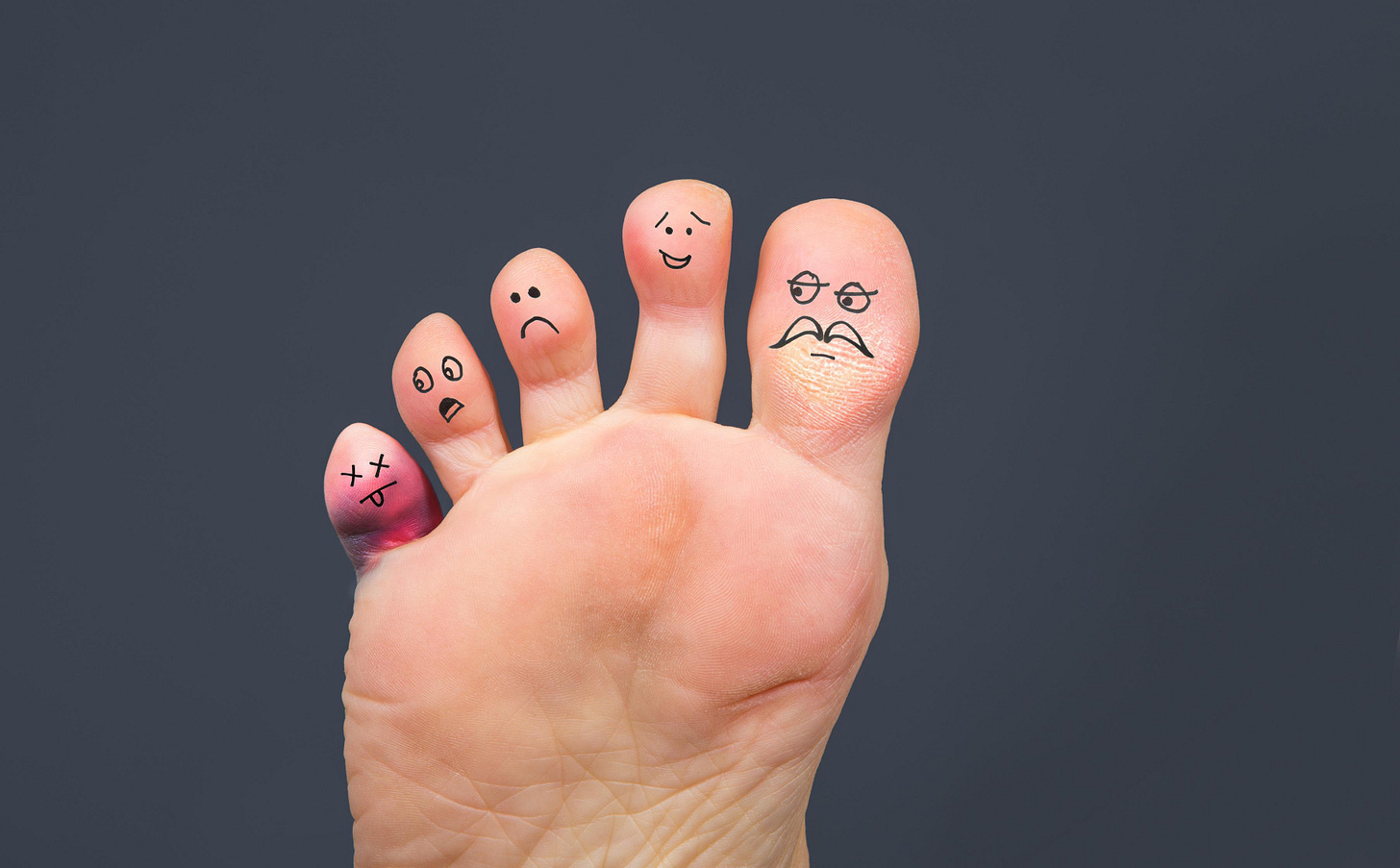 Everything You Need to Know About a Pinky Toe Bunion | NatraCure - NatraCure Everything You Need to Know About a Pinky Toe Bunion | NatraCure - NatraCure