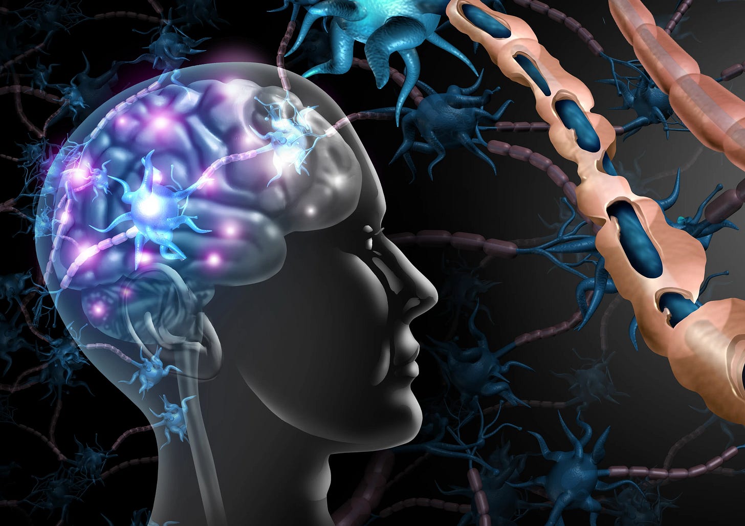 Illustration axe intestin-cerveau