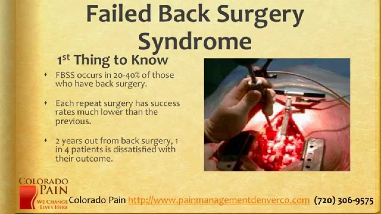 5 Things to Know About Failed Back Surgery Syndrome (FBSS)