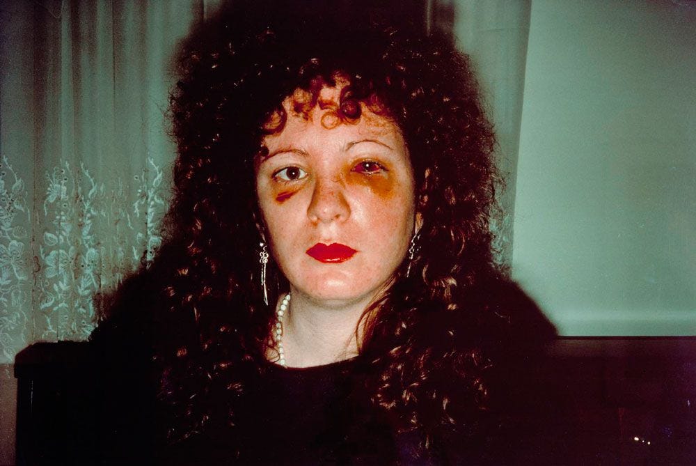 Retrato de uma mulher com cabelos cacheados e rosto machucado, apresentando um olho roxo e um hematoma na bochecha. Ela usa batom vermelho e brincos.
