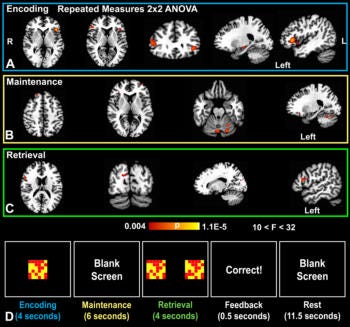 Methylene Blue Shows Promise for Improving Short-Term Memory | RSNA