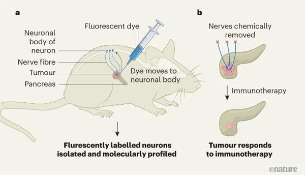 An infographic showing a nerve fibre associated with a pancreatic tumour in a mouse being identified with fluorescent dye and then chemically removed, allowing the tumour to respond to immunotherapy. 