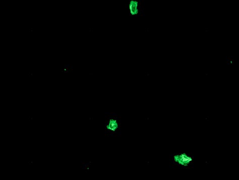 photos on the right and left are microclots.  they were fluorescent green blobs scattered against a dark background.  the middle picture is hyperactivated platelets - they are much smaller, bright red and yellow dots scattered against a black background