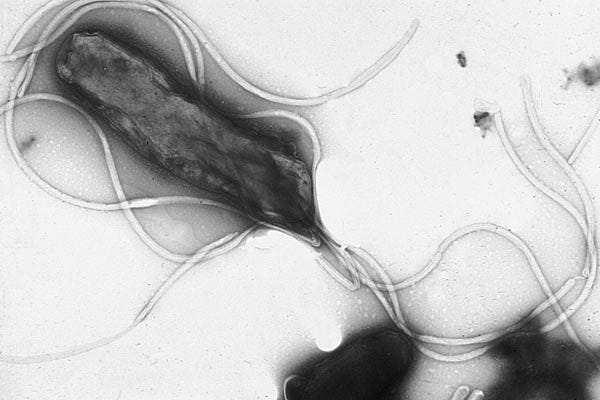 Transmission electron micrograph of Helicobacter pylori