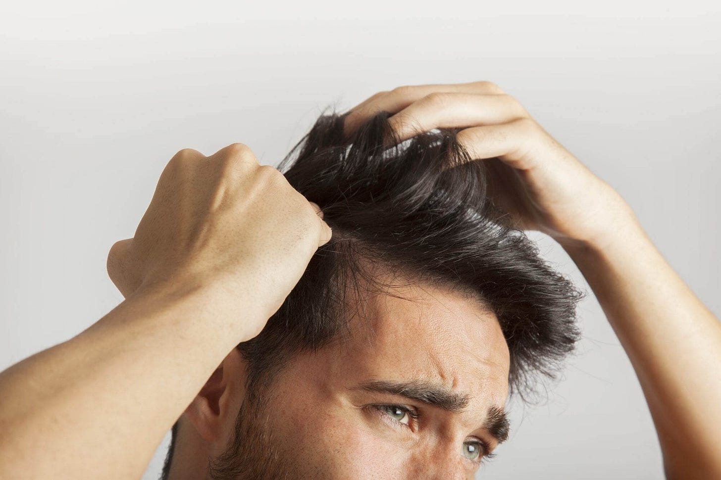 Psoriasi in testa: Rimedi, Cure e Accorgimenti Essenziali!