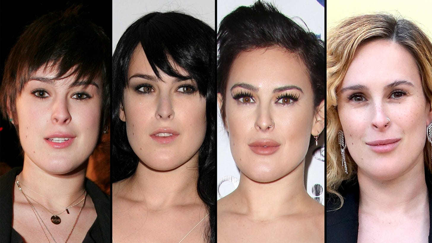 Rumer Willis Plastic Surgery: Transformation, Quotes | Life & Style Rumer Willis Plastic Surgery: Transformation, Quotes | Life & Style