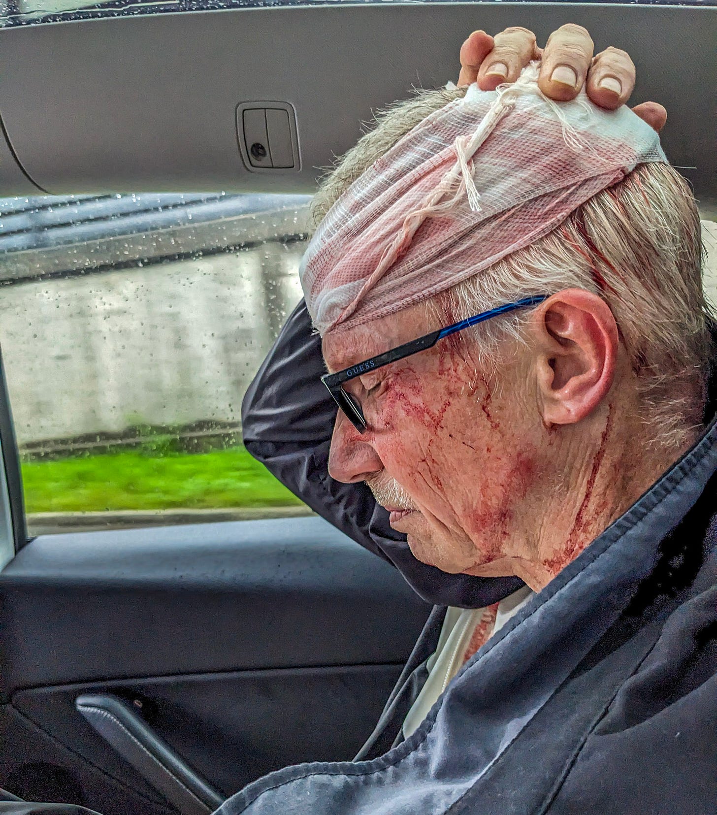 Michael in Uber, eyes closed, hand clutching his bloody bandaged head. 
