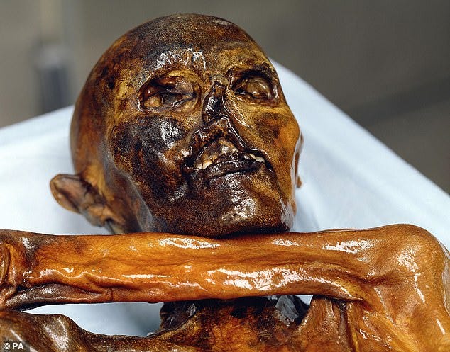 Ötzi the iceman