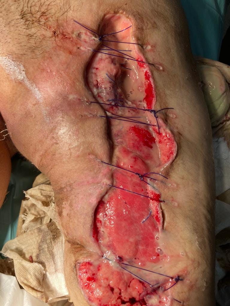 C:\Users\Felix Abt\Downloads\gore\IMG-20240128-WA0016.jpg C:\Users\Felix Abt\Downloads\gore\IMG-20240128-WA0016.jpg