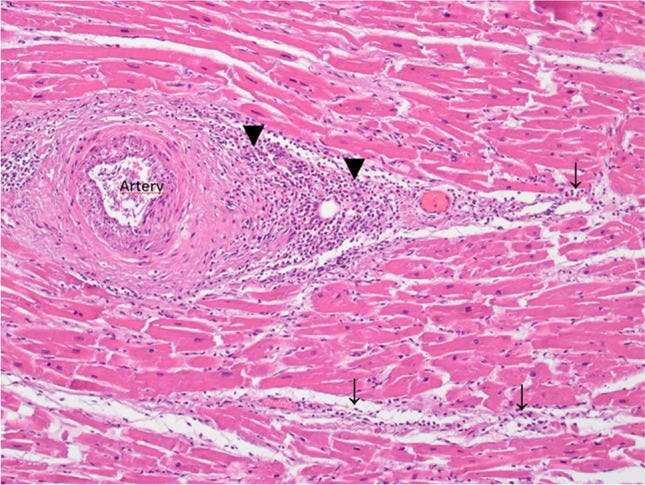 An external file that holds a picture, illustration, etc.
Object name is 414_2021_2706_Fig1_HTML.jpg