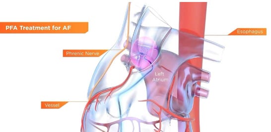 Article content Article content