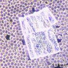 Nanotechnology In The Blood: A Compendium