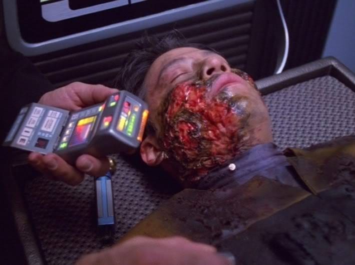 star trek robo surgery star trek robo surgery