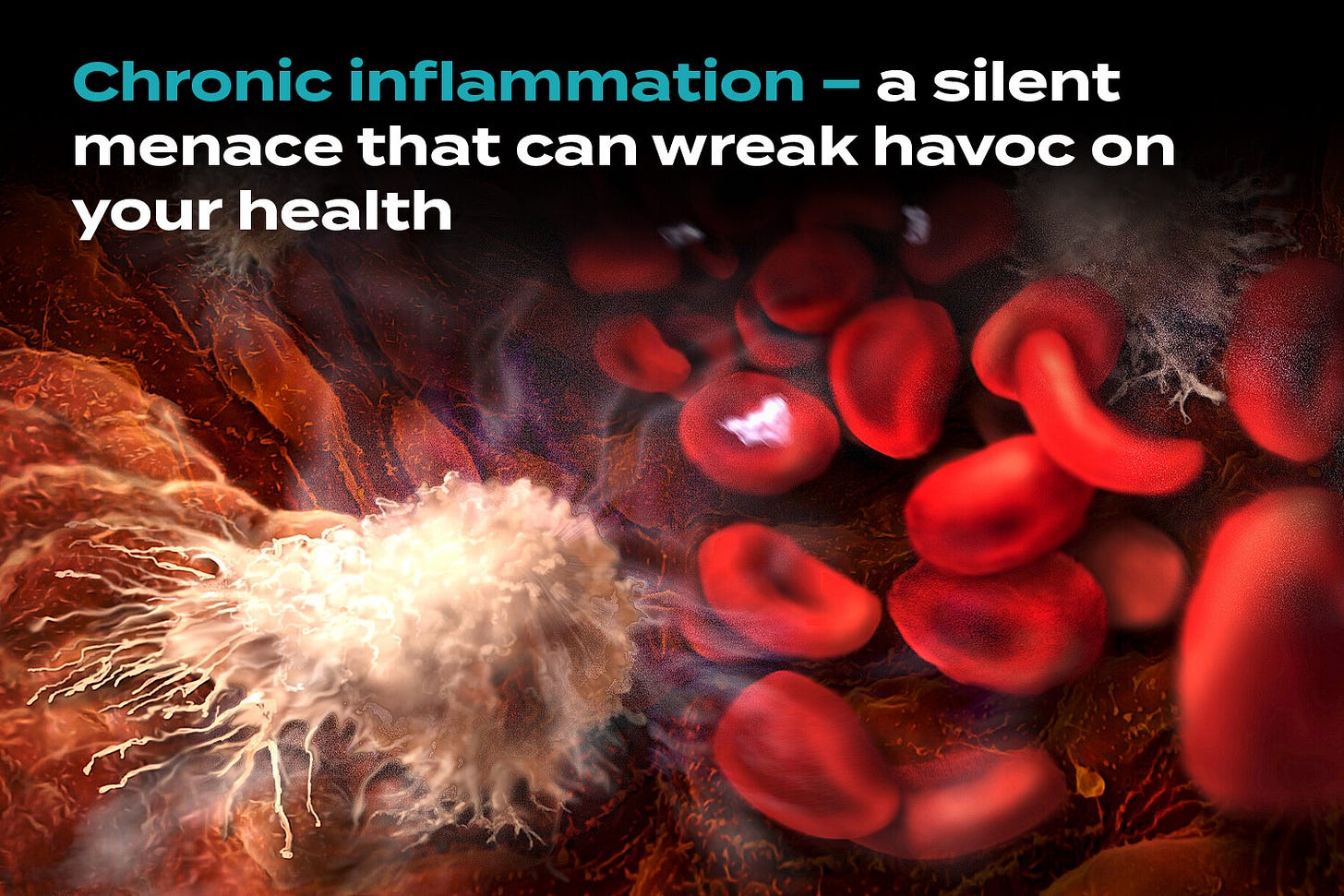 Inflammation Part 2: Understanding Chronic Inflammation's Impact on Your  Health - StoryMD
