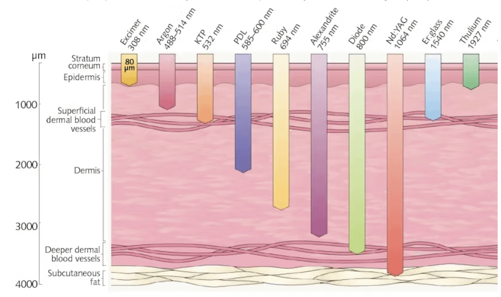 r/30PlusSkinCare - My Guide to Cosmetic Lasers and Laser Skin Resurfacing