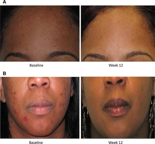 Fig. 4 Fig. 4