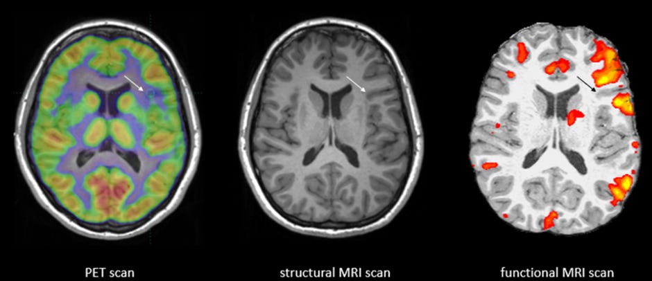 Know the difference between MRI and fMRI Know the difference between MRI and fMRI