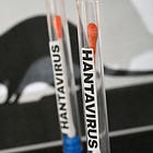 Hantavirus is a climate story