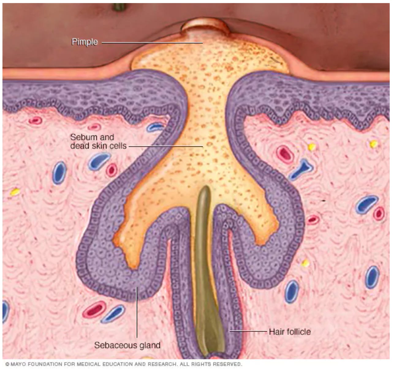 Hair follicle Hair follicle