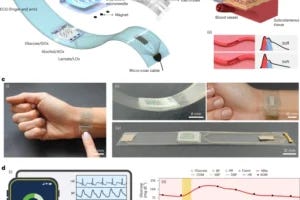 A wearable hybrid wristband integrates microneedles and ultrasound sensors to continuously monitor multiple biochemical markers (glucose, alcohol, lactate) and physiological signals (BP, HR, arterial stiffness) in real time, displaying and comparing multimodal health data on a digital interface.