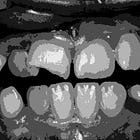 you'll always have the same teeth 