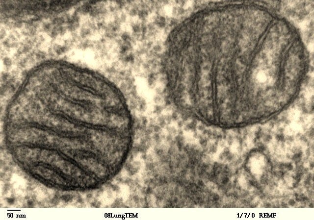 File:Mitochondria, mammalian lung - TEM.jpg