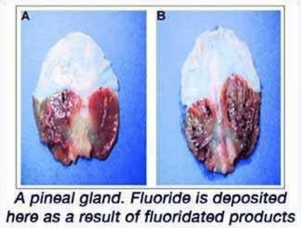 Fluoride and Pineal Gland