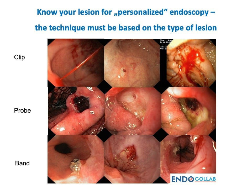 Close-up of several endoscopy Description automatically generated