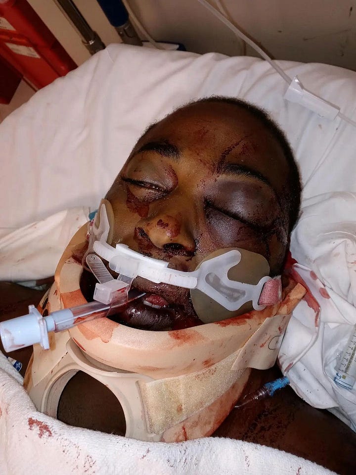 Autopsy findings courtesy of Clorissa Wright