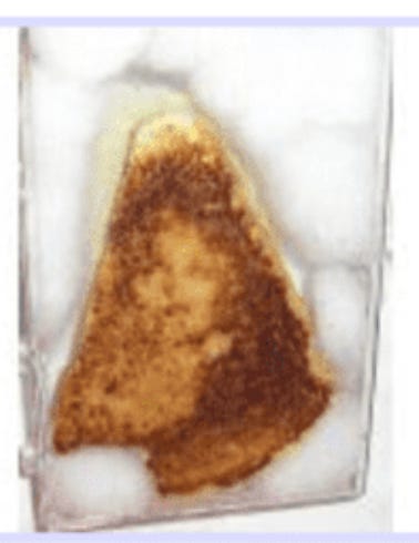notion image