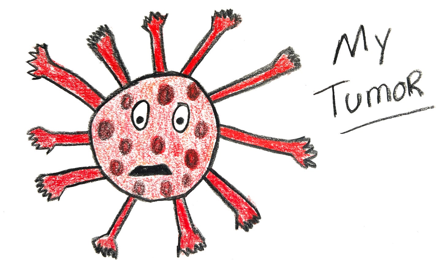 Victoria's drawing of her tumor