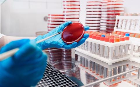 Blood Culture Test Overview, Process, Post-care & More