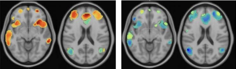 Brains 