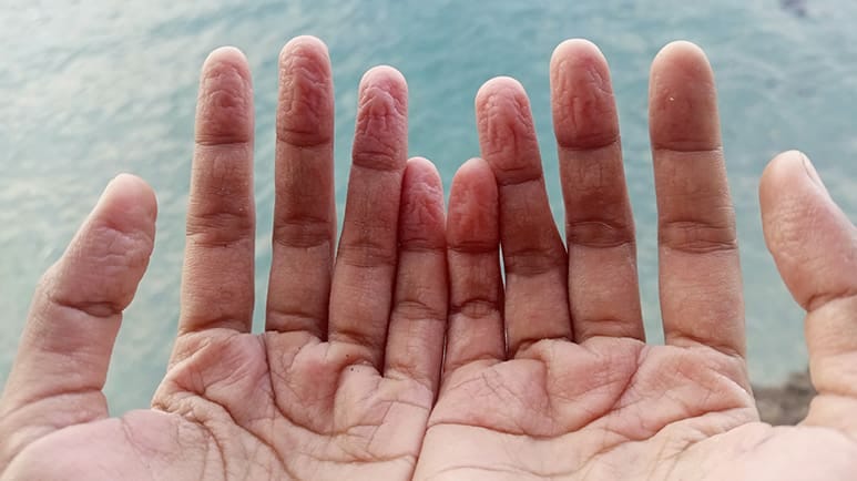 fingers toes get pruny water