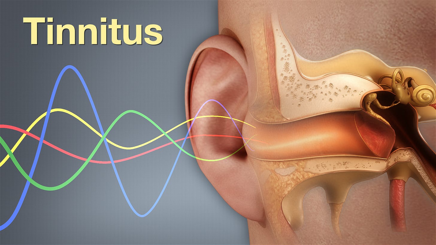 Tinnitus shown and explained using medical animation still shot Tinnitus shown and explained using medical animation still shot