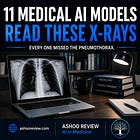 11 Medical AI Tools Read These Xrays