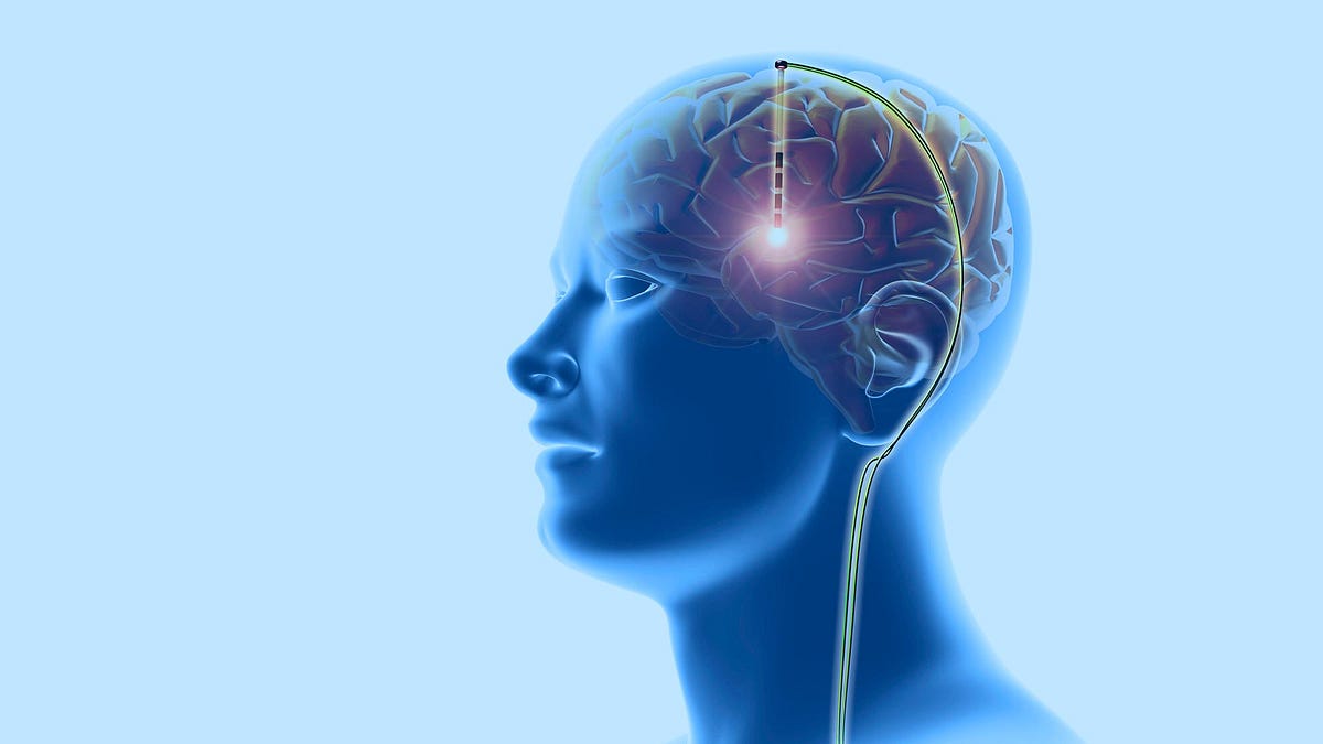 5 Types of Brain Stimulation Therapies: Purpose, E