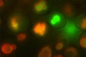 These optical microscopy images show the osteoyeast cells. The outline of the vacuole, the cellular organelle where calcium is accumulated to form hydroxyapatite, is fluorescing red. The calcium inside the vacuole is fluorescing green. (Credit: Behzad Rad/Berkeley Lab)